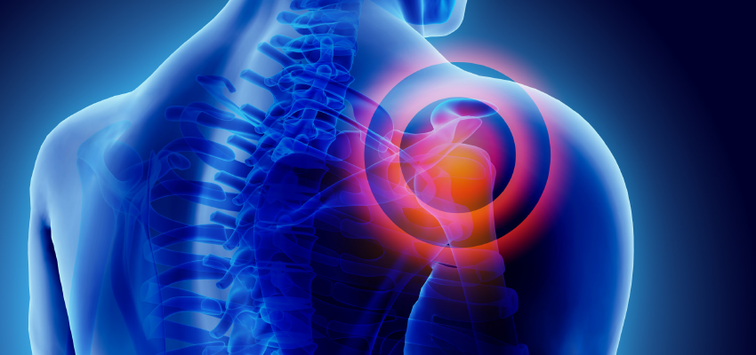 Leia mais sobre o artigo Tendinite do Ombro: Sintomas, Diagnóstico e Tratamentos Modernos